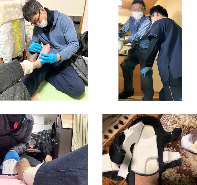 足病患者様向け訪問リハビリテーションの内容の一例
